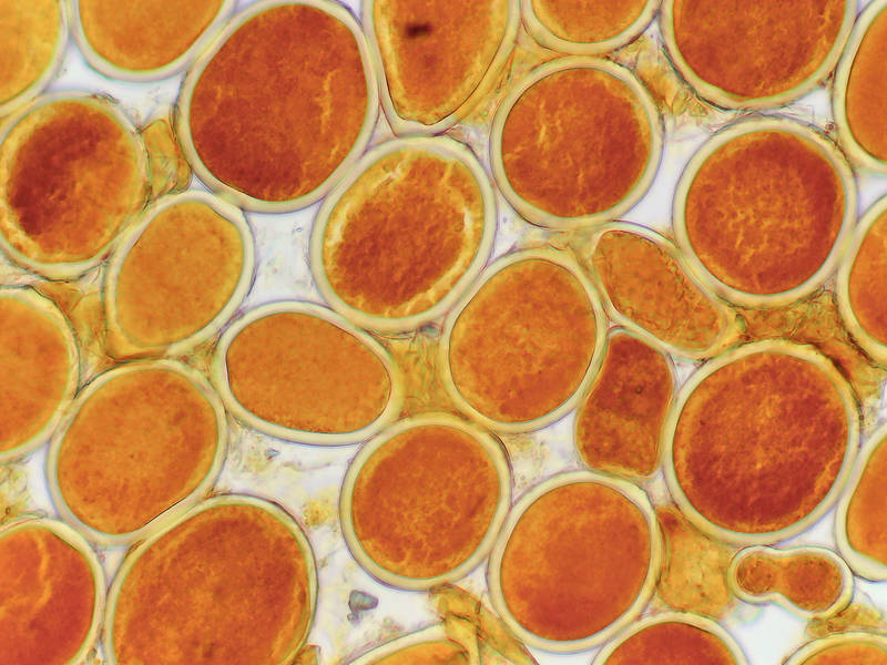 Spores of fungus <B>Sphaerosporium lignatile</B> under microscope, collected on Kiwanis Nature Trail. College Station, Texas, March 1, 2022